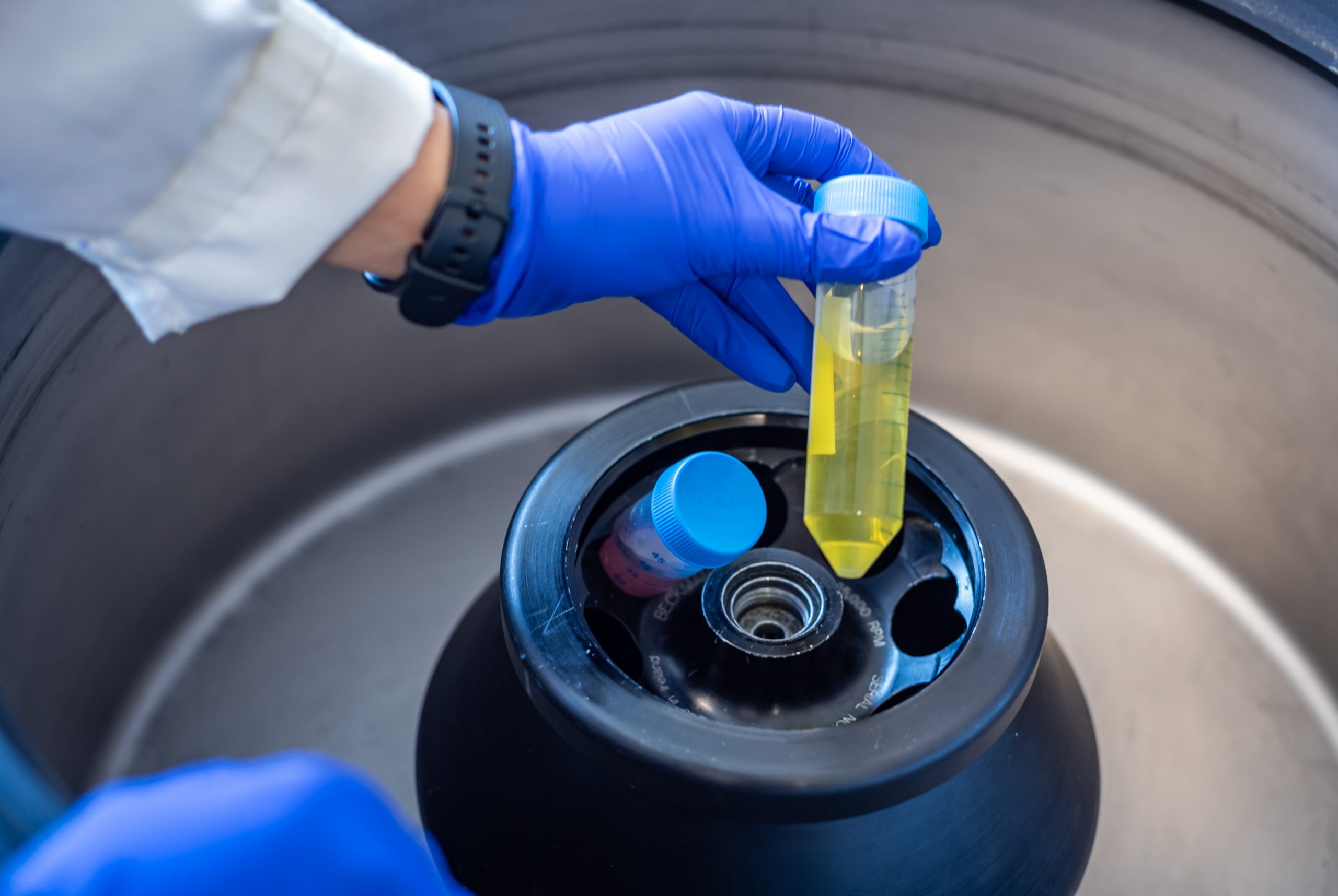 Centrifugeuse : un élément essentiel