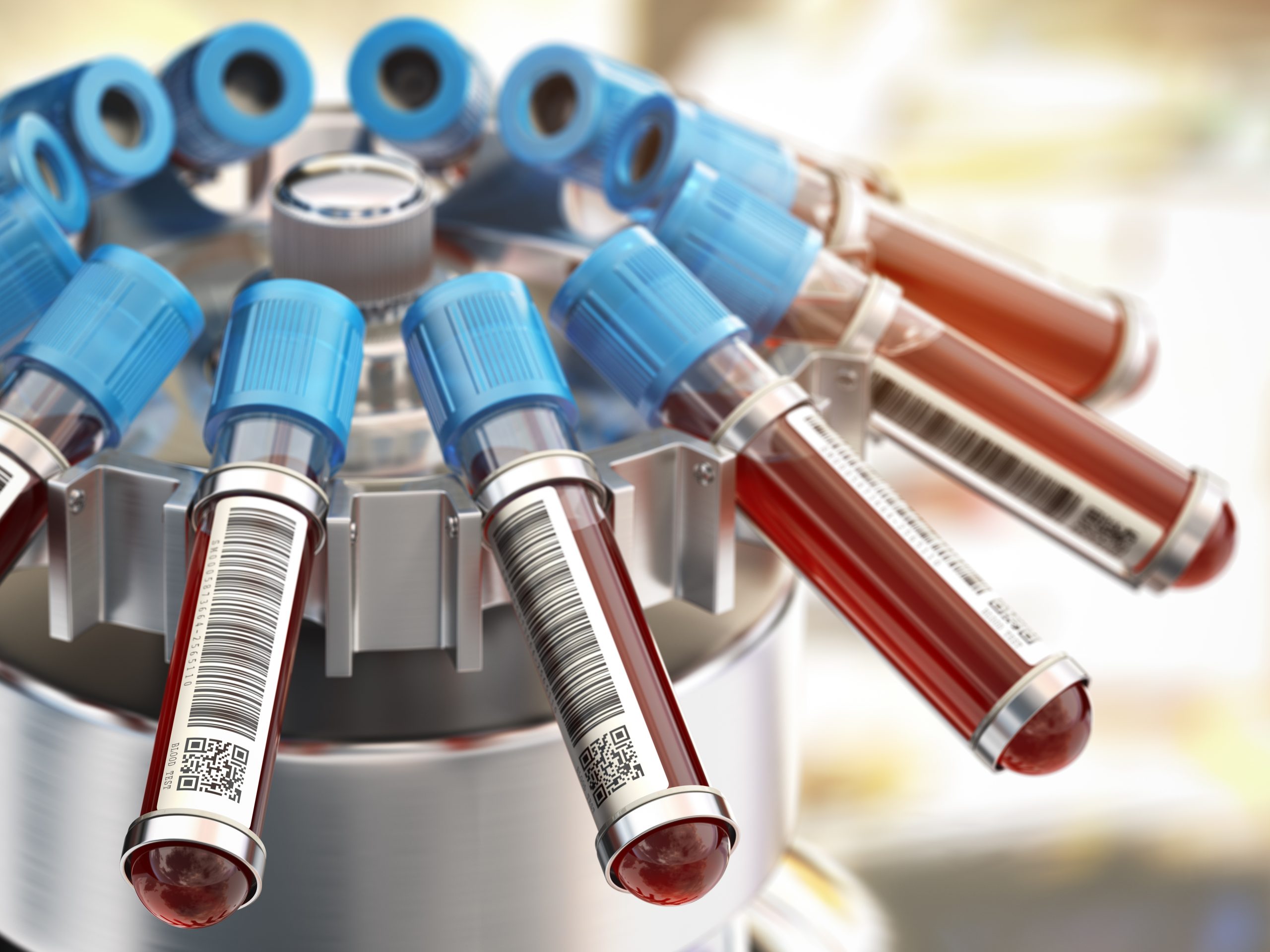 Qu'est-ce qu'une microcentrifugeuse?