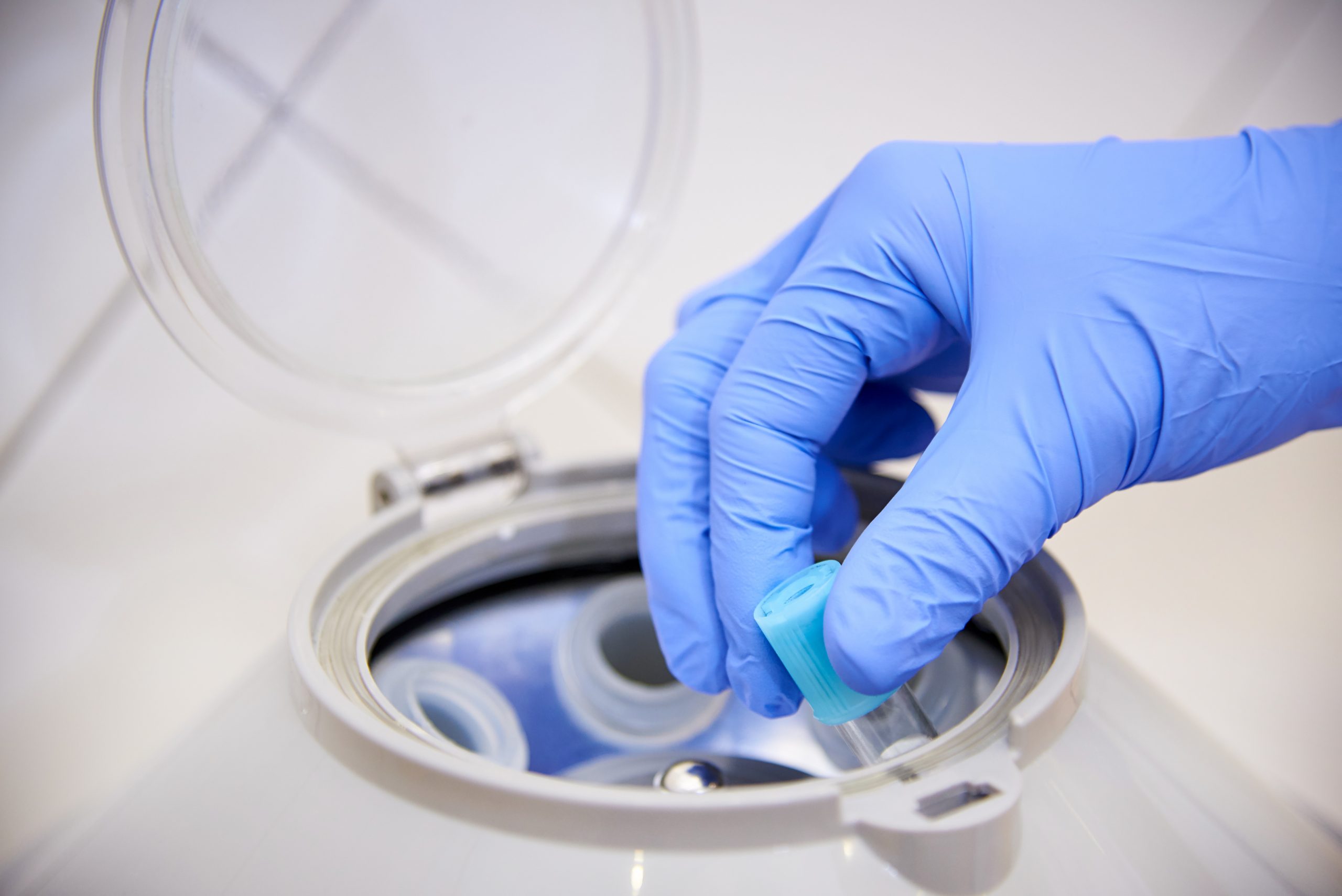 Qu'est-ce qu'une centrifugeuse à grande vitesse ?
