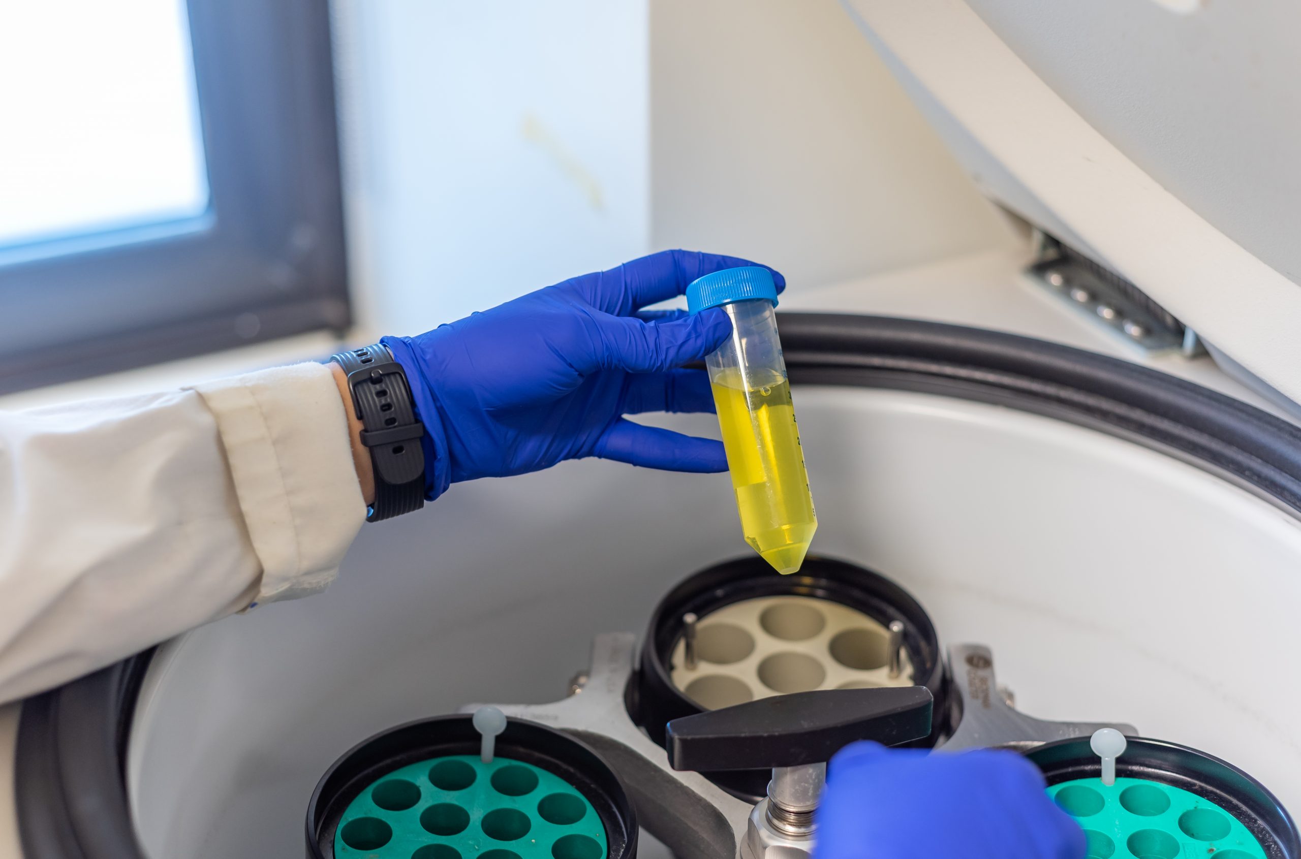 Centrifugeuse : Comment séparer les échantillons ?