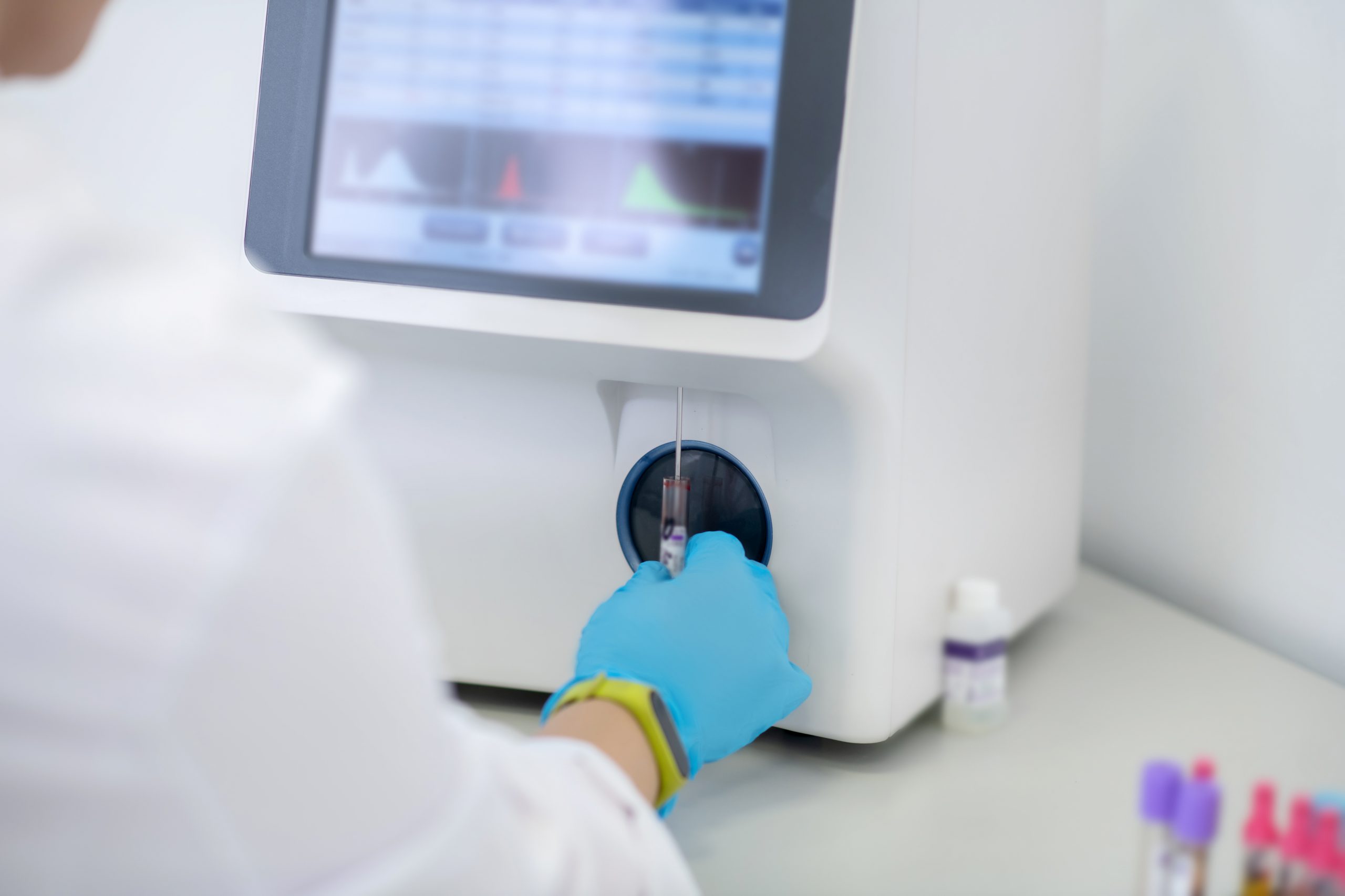 Types d'analyseurs de laboratoire clinique