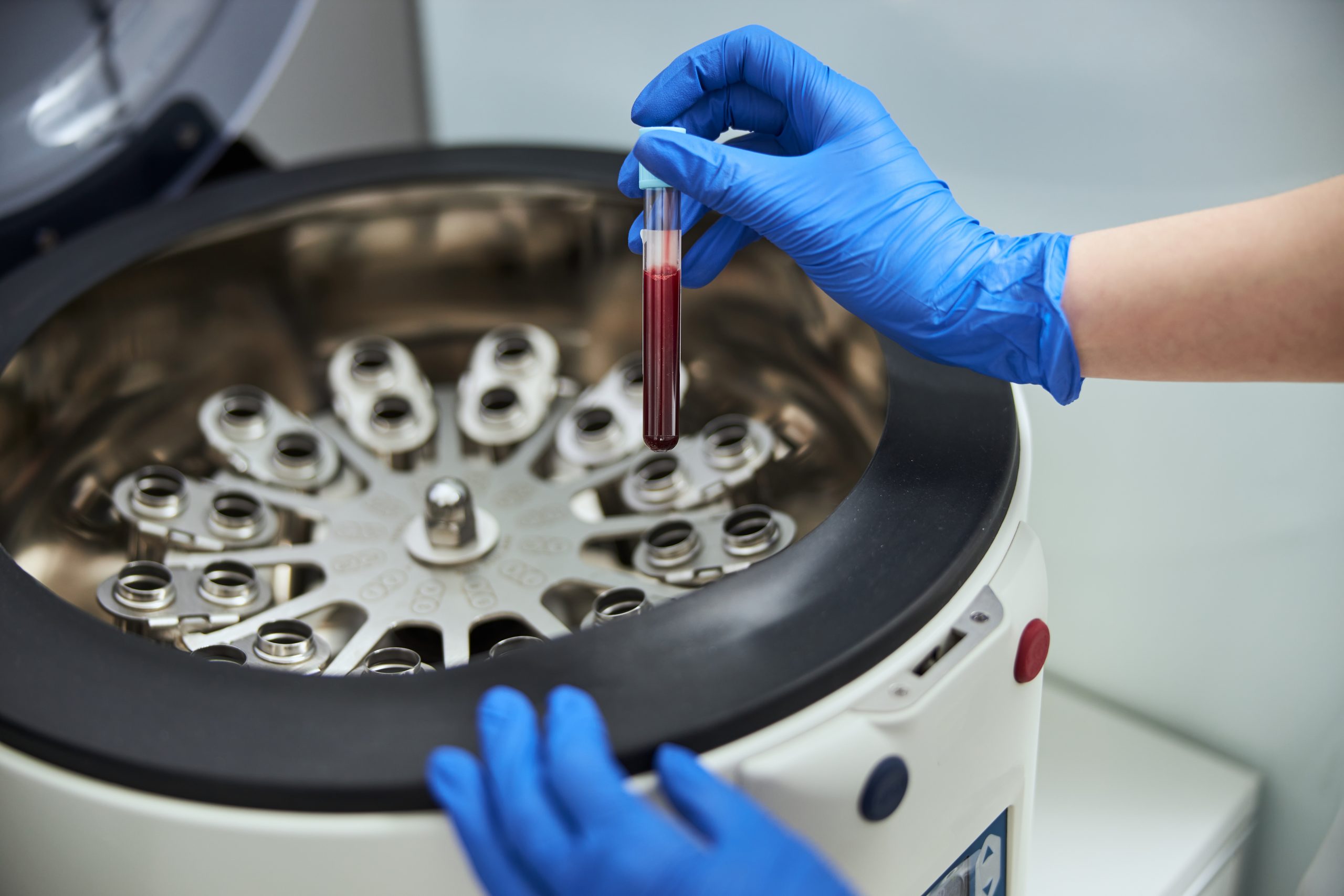 Centrifugeuses de laboratoire : Quelles sont les principales marques ?