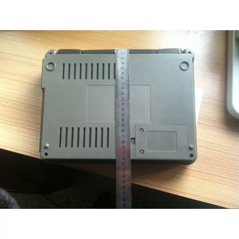 Moniteur ECG 12 Dérivations Interface USB/RS232 YR05160 – 1
