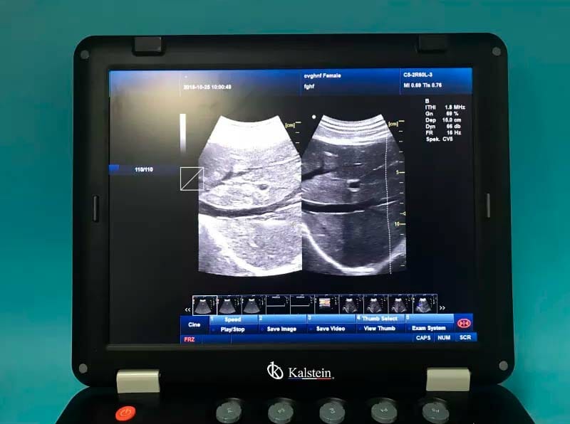 Découvrez le Scanner à Ultrasons : Une Révolution Technologique pour le Secteur Médical