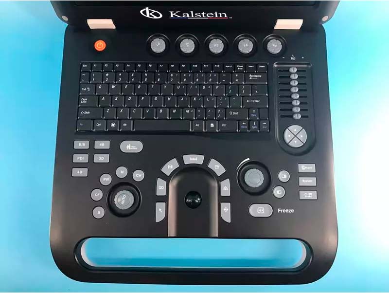 La Révolution du Diagnostic: Scanner A Ultrasons de Kalstein